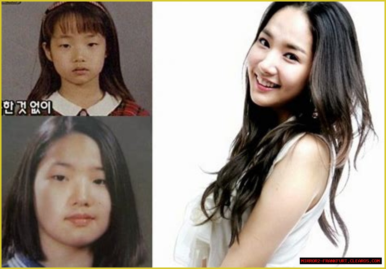 Park Min Young's Transformation: Uncovering The Journey Before Surgery