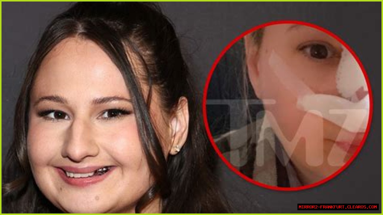 Unveiling The Transformation: The Nose Job Of Gypsy Rose